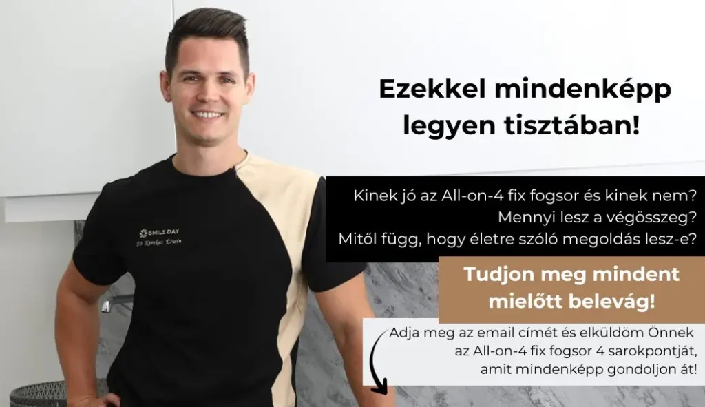 All-on-4 tudnivalók felsorolása mielőtt belevág.