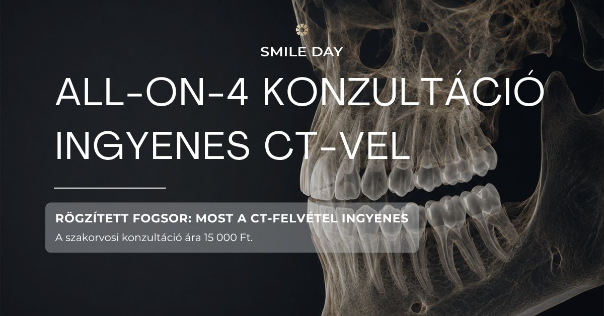 All-on-4 konzultáció akció